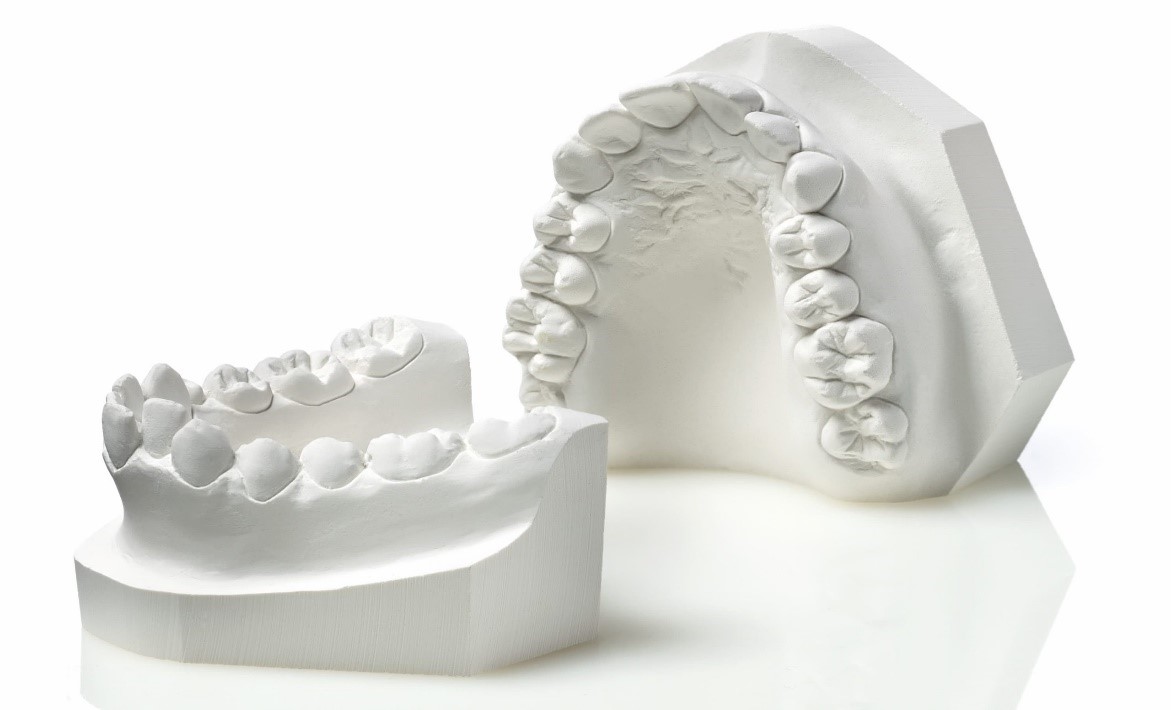 Modelos de Estudio – Dental RX